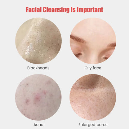 MTM™ - Deep Cleansing Electric Facial Cleanser - For Radiant Skin